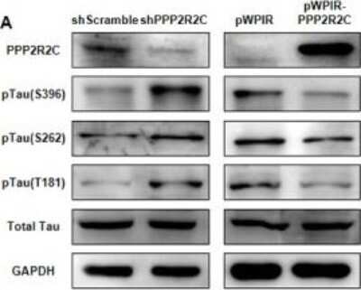 Western Blot: Tau [p Thr181] Antibody [NB100-82245]